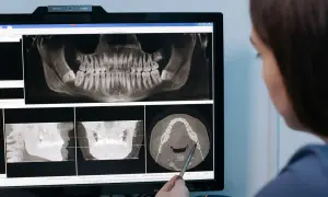 Dentysta analizuje zdjęcia RTG szczęki, planując powtórne leczenie kanałowe.