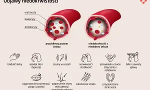 Porównanie prawidłowego poziomu żelaza z niedoborem. Niedobór żelaza prowadzi do anemii, objawiającej się m.in. bladością skóry, zmęczeniem i bólami głowy.