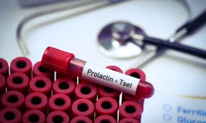Prolaktyna: Kiedy badać? Twój przewodnik do wiarygodnych wyników