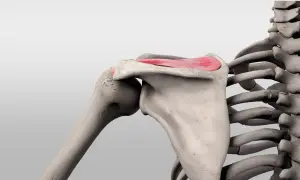Schulterknochen mit hervorgehobenem musculus supraspinatus, der für die Armhebung wichtig ist.