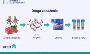 Droga zakażenia czerwonką: brudne ręce i surowe mięso prowadzą do pałeczek Shigella, objawów bólu brzucha i badań kału.