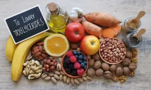 Zdrowe produkty spożywcze, które pomagają obniżyć trójglicerydy: owoce, orzechy, nasiona, fasola, bataty, czosnek, oliwa.