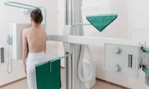 Kobieta przygotowuje się do badania RTG klatki piersiowej. Aparatura medyczna otacza ją, a zielona osłona chroni przed promieniowaniem.