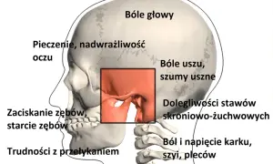 Bruksizm szczeka, powodując bóle głowy, uszu, problemy ze stawami skroniowo-żuchwowymi, pieczenie oczu, zaciskanie i starcie zębów, trudności z przełykaniem oraz ból karku, szyi i pleców.