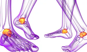 Anatomie du pied : vue latérale des os de la cheville, mettant en évidence le talus, un os clé de la malléole.