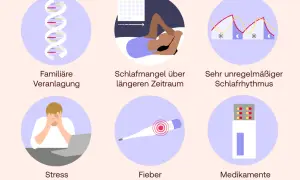 Ursachen für Schlafwandeln: familiäre Veranlagung, Schlafmangel, unregelmäßiger Schlafrhythmus, Stress, Fieber, Medikamente.