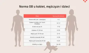 Tabela przedstawia normy odczynu Biernackiego (OB) dla różnych grup wiekowych i płci, od noworodków po kobiety w ciąży.