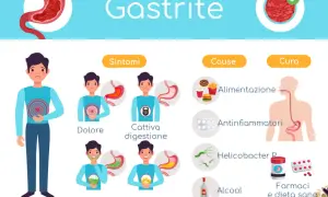 Illustrazione sulla gastrite cronica: sintomi (dolore, cattiva digestione, nausea, bruciore), cause (alimentazione, antinfiammatori, Helicobacter P, alcool) e cura (farmaci, dieta sana).