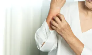 Dłoń drapie zaczerwienioną skórę na ramieniu. Czy to objaw, że candida atakuje?