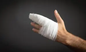 Złamany palec ile w gipsie: dowiedz się, jak długo trwa leczenie