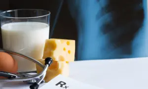 Szklanka mleka, ser, jajko i stetoskop na tle zdjęcia rentgenowskiego. Lekarz zalecił wapno do picia dla zdrowych kości.