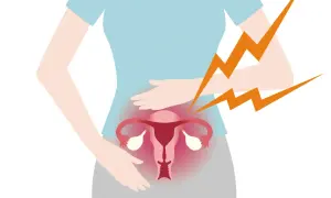 Illustration av en gravid kvinna som håller sig om magen. Hon upplever ilningar i underlivet, symboliserat av blixtar.