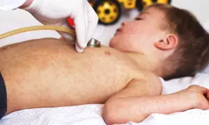 Läkare undersöker ett barn med utslag, möjligen biverkningar efter 5 månaders vaccin.