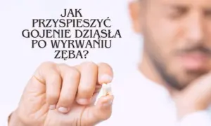 Jak przyspieszyć gojenie dziąsła po wyrwaniu zęba i uniknąć bólu
