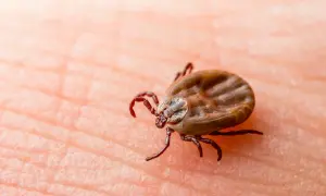 Makro zbliżenie kleszcza na skórze. Dowiedz się, jak pozbyć się kleszczy z ogrodu i uniknąć zagrożeń.