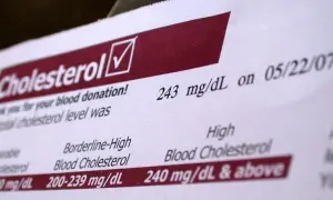 Jak oznaczony jest cholesterol na wynikach? Zrozum swoje wyniki zdrowotne