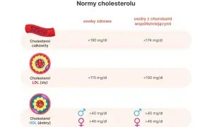 Czy cholesterol 240 to dużo? Normy, zagrożenia i skuteczne sposoby na obniżenie