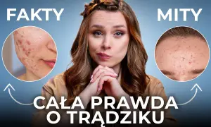 Jak dbać o cerę trądzikową? Mity, fakty i plan czystej skóry