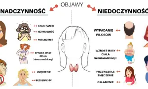 Objawy nadczynności tarczycy u osób starszych – jak je rozpoznać?