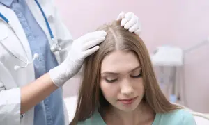Lekarz w białej rękawiczce bada skórę głowy pacjentki. Czy potrzebuję skierowanie do dermatologa?