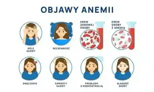 Zmęczenie, apatia, lęk? To może być niedobór żelaza! Jak leczyć?