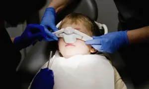 Leczenie zębów pod narkozą u dzieci NFZ - gdzie i na jakich warunkach?
