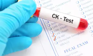 Ręka w niebieskiej rękawiczce trzyma probówkę z krwią do badania CK. Na formularzu zaznaczono CPK (Total).