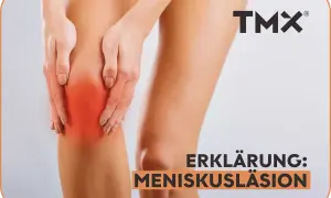 Hände umfassen schmerzendes Knie, rot markiert. Text: "ERKLÄRUNG: MENISKUSLÄSION". Mögliche triggerpunkte knieschmerzen innenseite.