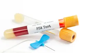 PSA co to za badanie? Kluczowe informacje o zdrowiu prostaty