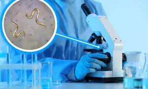 Badacz w rękawiczkach bada pod mikroskopem próbkę kału, w której widoczne są pasożyty.