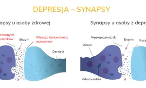 Czym jest depresja? Poznaj objawy i skutki tej trudnej choroby