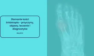 Rentgen stopy z widocznym złamaniem kości śródstopia.