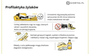 Jak zapobiec żylakom? Pełny przewodnik do zdrowych nóg!