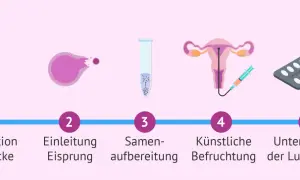 Der Insemination Ablauf: Stimulation der Eierstöcke, Eisprung-Einleitung, Samenvorbereitung, künstliche Befruchtung, Lutealphase-Unterstützung.