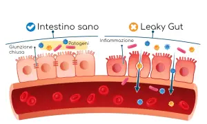 Intestino sano con giunzione chiusa e patogeni bloccati. Leaky gut con infiammazione, dove i patogeni attraversano la barriera intestinale.