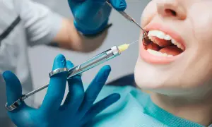 Ile kosztuje znieczulenie u dentysty na nfz? To może zaskoczyć!