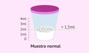 Recipiente con muestra de semen, indicando que la cantidad normal de espermatozoides en una eyaculación es mayor a 1,5ml.
