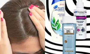 Szukasz skutecznych rozwiązań na łupież? Sprawdź pirolam opinie i porównaj z Head & Shoulders i Pharmaceris.