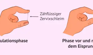 Hände zeigen Zervixschleim: zähflüssig in der Ovulationsphase, klumpig davor/danach. Ein Zeichen für Fruchtbarkeit bei Frauen.