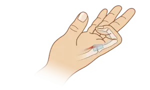 Illustration einer Hand, die zeigt, wie die Finger schmerzen beim Beugen durch eine Entzündung im Sehnenbereich.