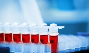 Próbówki z czerwoną krwią, badanie obniżonego hematokrytu w ciąży.