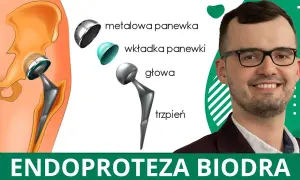 Gdzie na rehabilitację po endoprotezie biodra? NFZ vs. prywatnie
