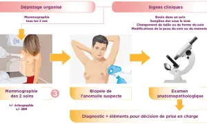 Un examen anatomopathologique suit une biopsie, étape clé pour le diagnostic.