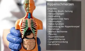 Anatomisches Modell zeigt Ursachen für Schmerzen Rippen links seitlich bei Bewegung, wie Prellung, Zerrung oder eingeklemmter Nerv.