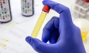Ręka w niebieskiej rękawiczce trzyma probówkę z żółtym płynem. W tle widać paski do badania moczu i inne probówki. Wyniki posiewu moczu ile trwa, zależą od laboratorium.