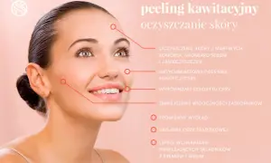 Peeling kawitacyjny: oczyszczenie, poprawa kondycji, wyrównanie kolorytu, redukcja zaskórników, promienny wygląd. Brak negatywnych efektów ubocznych.
