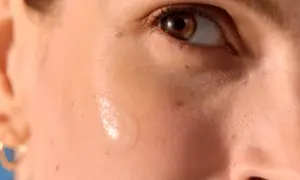 Goccia di siero su pelle con leggere macchie solari sul viso.