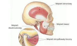 Anatomia żuchwy z zaznaczonymi mięśniami: skroniowym, żwaczem i skrzydłowatym bocznym. Powiększenie pokazuje staw skroniowo-żuchwowy, kluczowy przy bruksizmie objawy.