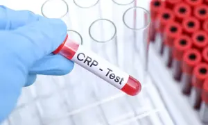 Rękawiczka w niebieskiej rękawiczce trzyma probówkę z napisem "CRP - Test". To badanie CRP pomaga wykryć stan zapalny w organizmie.