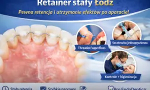 Retainer stały to pewna retencja zębów po leczeniu ortodontycznym. Pokazano higienę z użyciem nici dentystycznej i szczoteczki jednopęczkowej.